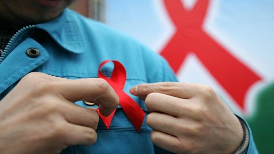 Comportamiento del VIH-SIDA e Infecciones de Transmisión Sexual en Cienfuegos