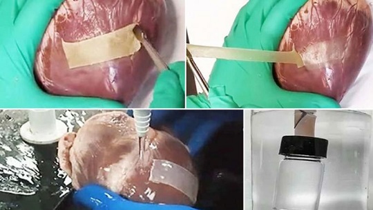 Un nuevo parche de hidrogel doble cara podría reparar eficientemente corazones infartados