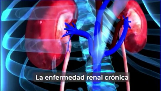 📹 Enfermedad renal crónica