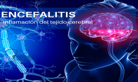 La encefalitis y la meningo