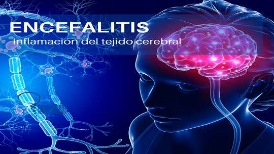 🎧 El Triángulo de la confianza: Encefalitis y la meningoencefalitis