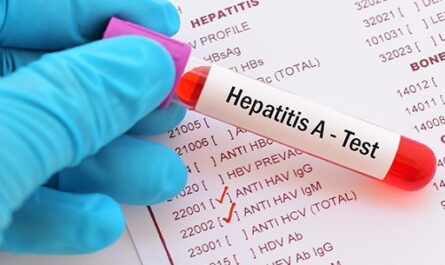 Alerta-autoridad-sanitaria-de-Cienfuegos-sobre-sintomas-de-hepatitis