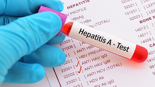 📹 Alerta autoridad sanitaria de Cienfuegos sobre síntomas de hepatitis A