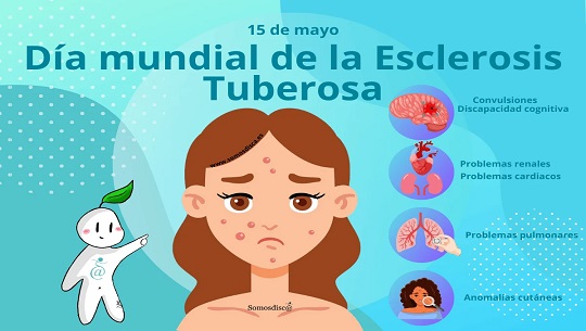 Día Internacional de la Esclerosis Tuberosa