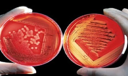Dia-Mundial-del-Microbioma
