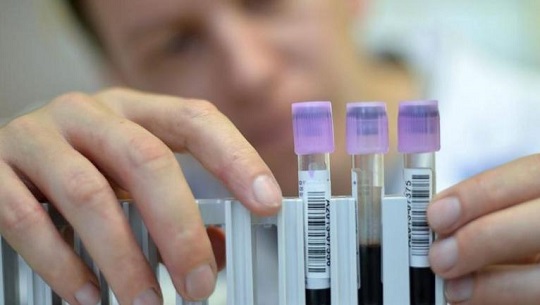 Un análisis de sangre podría predecir el parkinson siete años antes de los síntomas