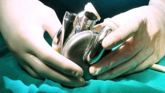 Implantan primer corazón artificial de larga duración del mundo