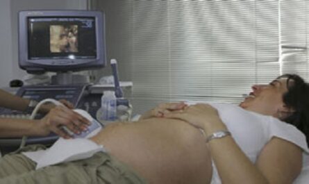 Dia-Internacional-de-la-Obstetricia