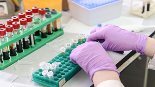 Dia-Internacional-de-la-Hepatitis-C